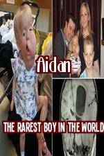 Watch Aidan The Rarest Boy In The World Movie2k