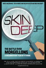 Watch Skin Deep: The Battle Over Morgellons Movie2k