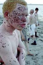 Watch Albino United Movie2k