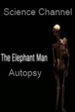 Watch Science Channel Elephant Man Autopsy Movie2k