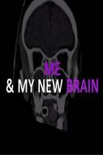 Watch Me & My New Brain Movie2k