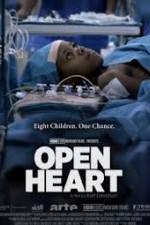 Watch Open Heart Movie2k