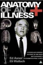 Watch Anatomy of an Illness Movie2k