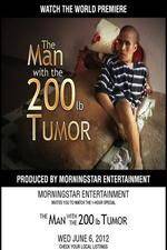 Watch The Man With The 200lb Tumor Movie2k