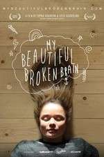 Watch My Beautiful Broken Brain Movie2k