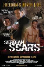 Watch Serbian Scars Movie2k