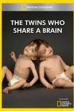 Watch National Geographic The Twins Who Share A Brain Movie2k