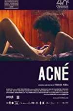 Watch Acné Movie2k