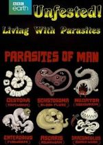 Watch Infested! Living with Parasites Movie2k