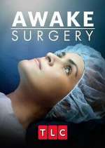 Watch Awake Surgery Movie2k