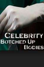 Watch Celebrity Botched Up Bodies Movie2k